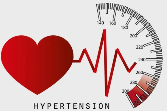 हाइपरटेंशन - 140 से 300 तक अंकित प्रेशर गेज के सामने बना हृदय और नाड़ी का ग्राफ़