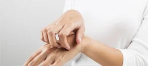 Una donna con una maglia bianca che si gratta la pelle dell'avambraccio