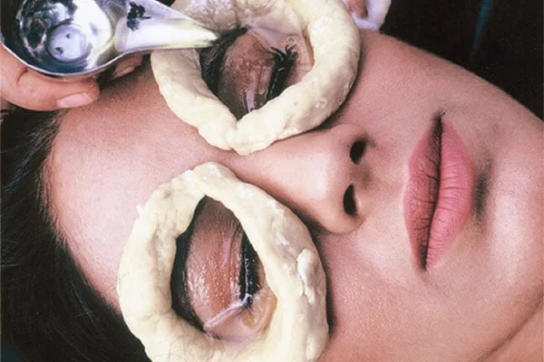 환자의 두 눈 주위에 만든 반죽 링 안으로 부어지는 약용 오일