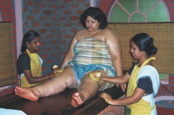 Ayurveda weight management